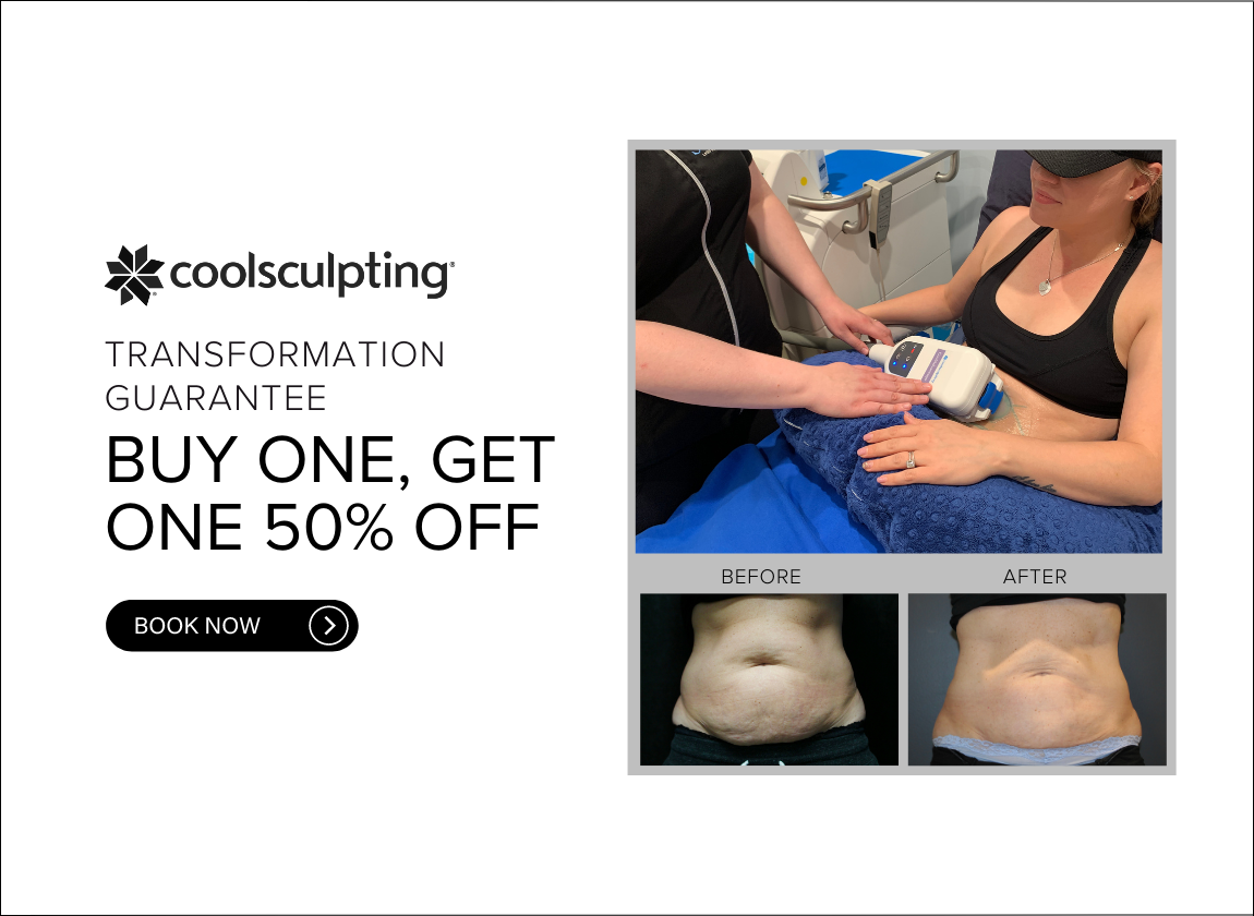 COOLSCULPTING CALGARY PROMOTION