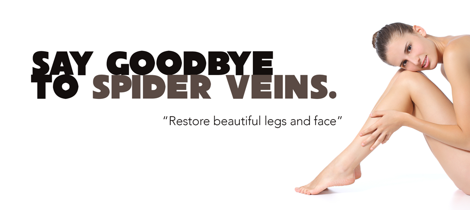 Spiderveins removal calgary